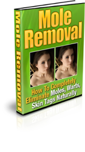 Mole Removal