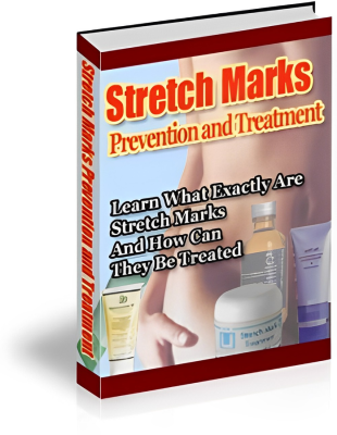 Stretch Marks Prevention and Treatment